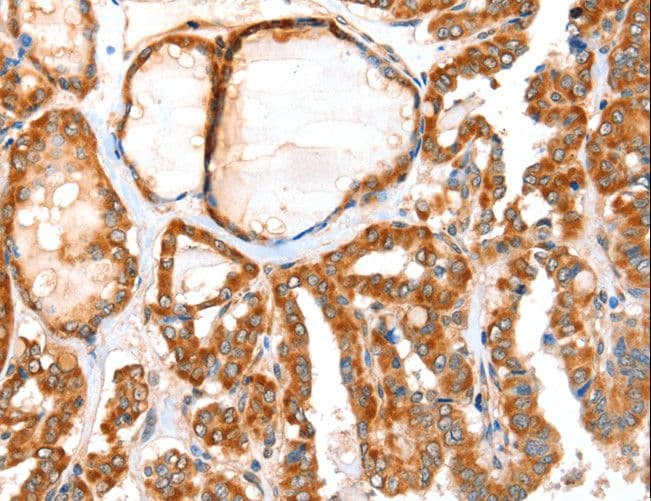 ACOX1 / ACOX Antibody