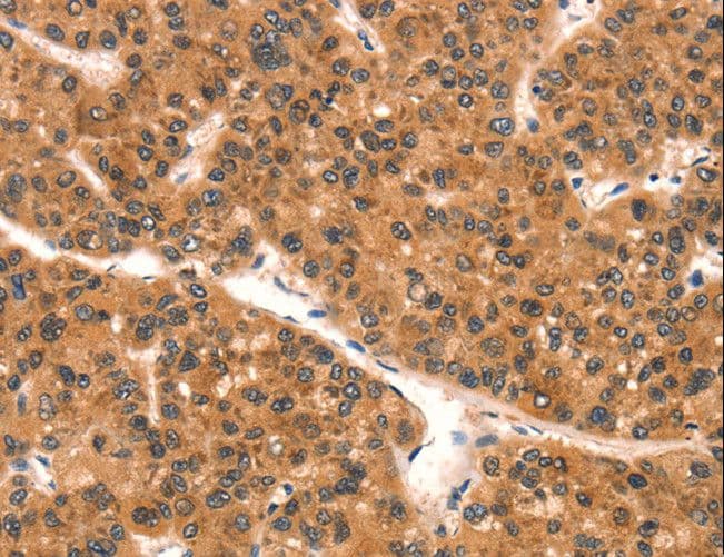 SPINLW1 / EPPIN Antibody