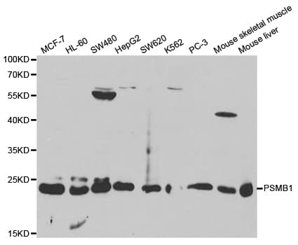 PSMB1 Antibody