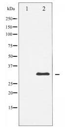 Polyclonal Rabbit anti-Human NPM1 / NPM / Nucleophosmin Antibody (IF, WB)