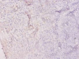 HPRT1 / HPRT Antibody
