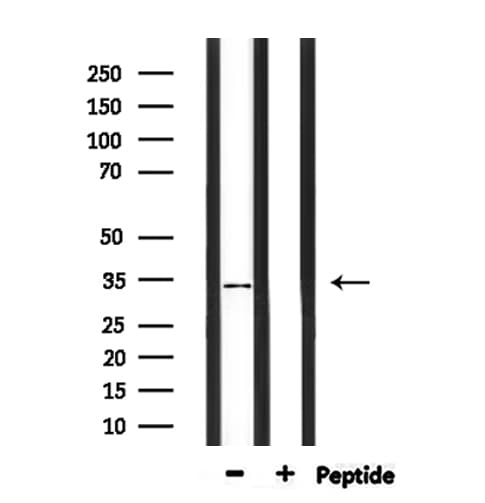 PIGC Antibody