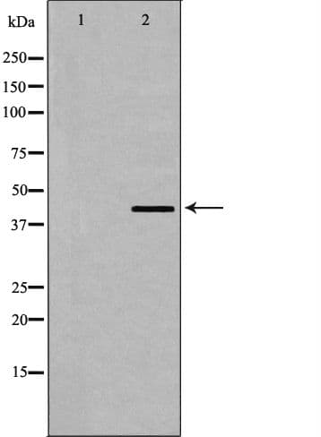 DMTN / Dematin Antibody