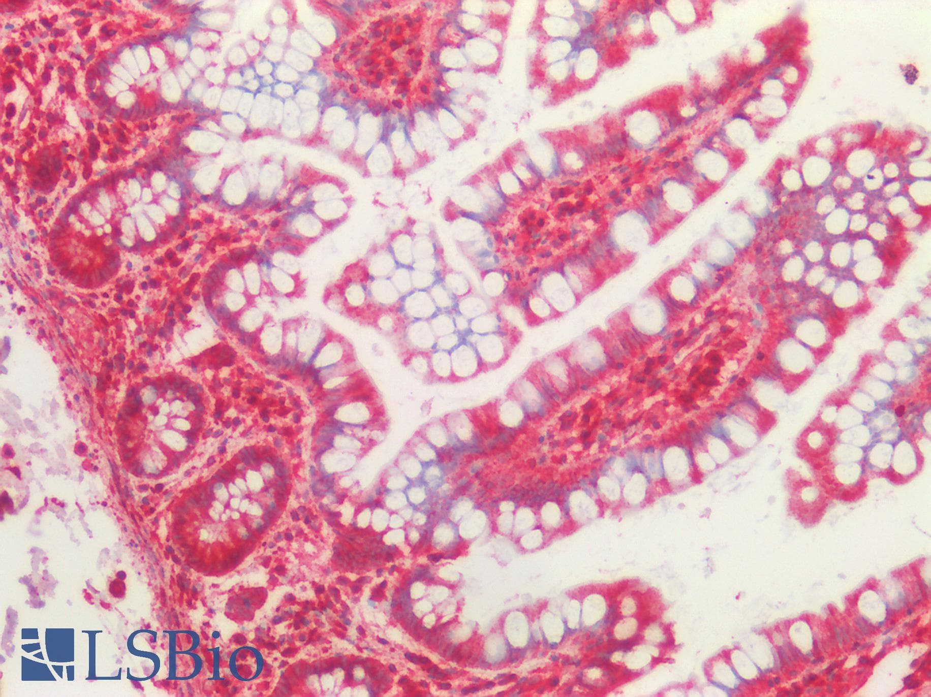IHC-plus™ TUBB / Beta Tubulin Antibody (aa238-429)