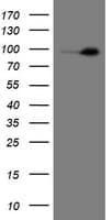 MME / CD10 Antibody (clone OTI3D11)