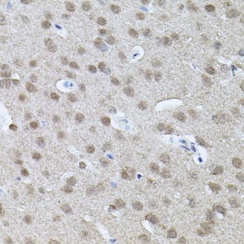 RNF166 Antibody