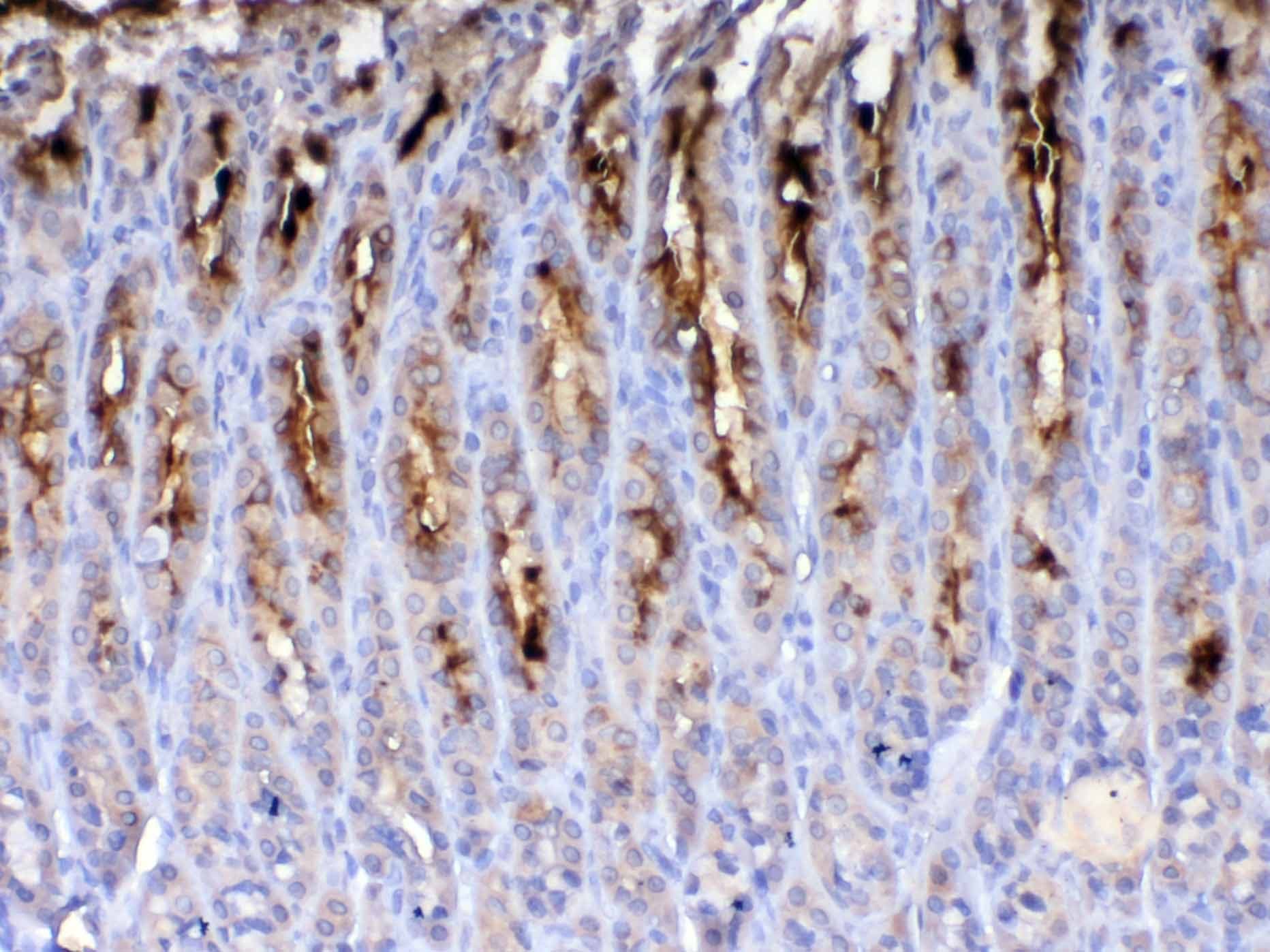 TFF2 / SP Antibody