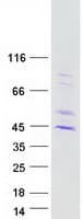 Human HUM2DD / DHDH Protein (Recombinant Myc-DDK (Flag))
