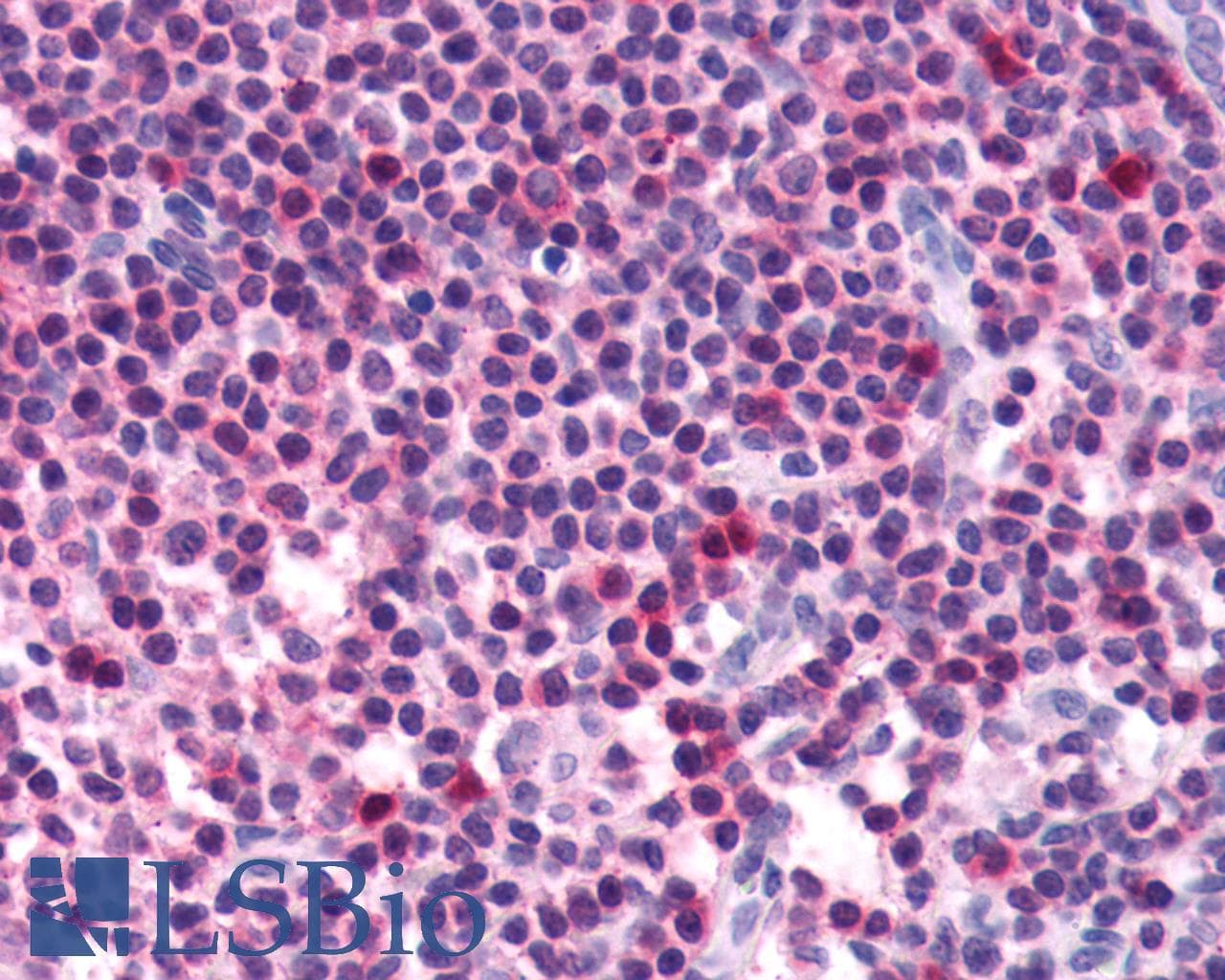 PathPlus™ FZD5 / Frizzled 5 Antibody (N-Terminus)