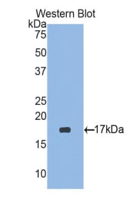 RARRES2 / Chemerin Antibody (aa33-158)