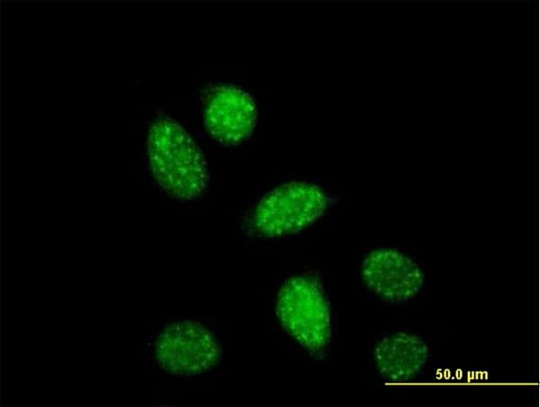 IHC-plus™ CREB1 / CREB Antibody (clone 3F1-1B2)
