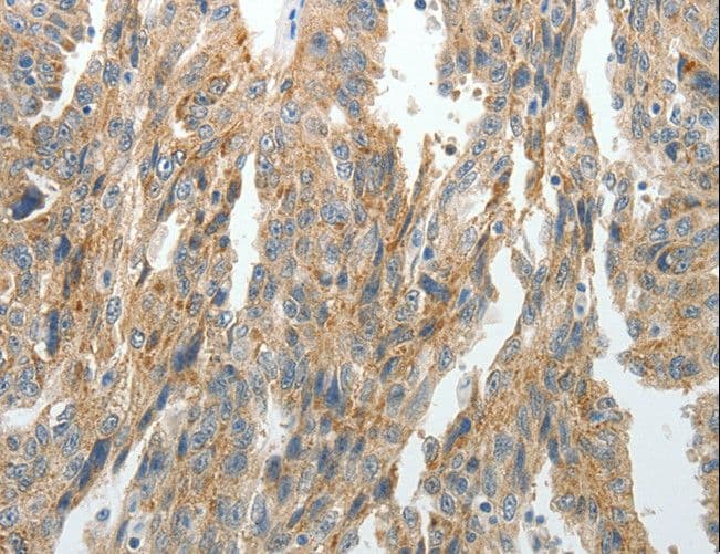 PRDX5 / Peroxiredoxin 5 Antibody