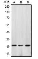CASP4 / Caspase 4 Antibody (Internal)