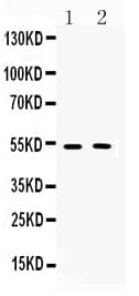Polyclonal Rabbit anti-Human CHRM2 / M2 Antibody (WB)