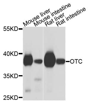 OTC Antibody