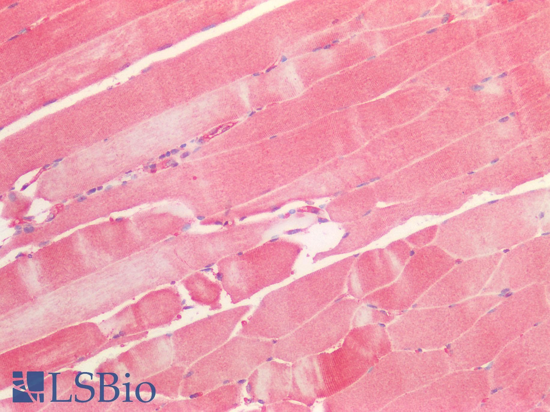 SEMA3C / Semaphorin 3C Antibody (aa292-396)