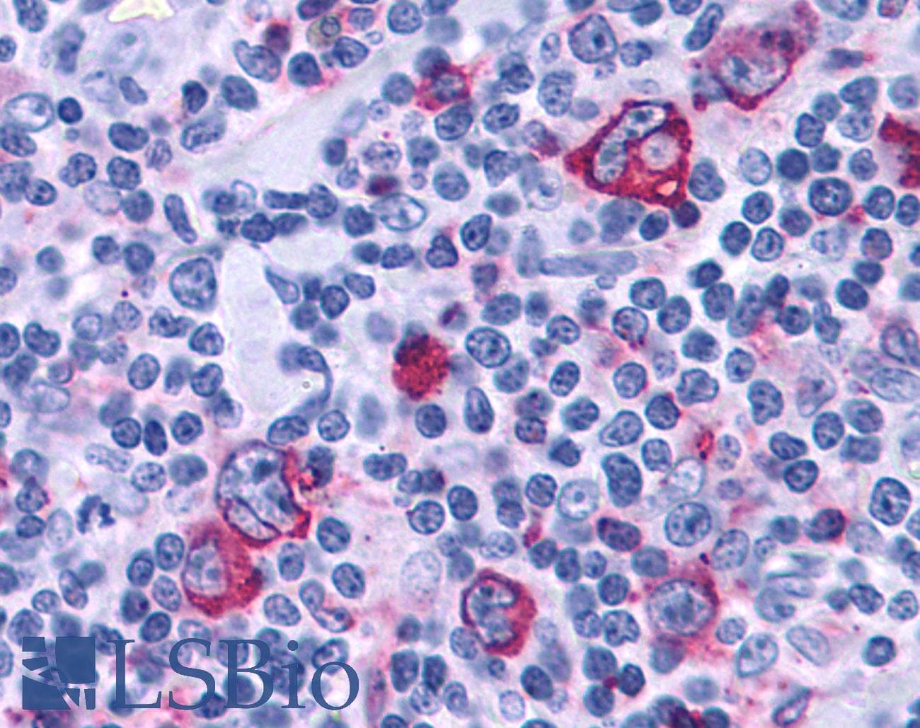 IHC-plus™ Polyclonal Rabbit anti-Human P2RY4 / P2Y4 Antibody (Cytoplasmic Domain, IHC)