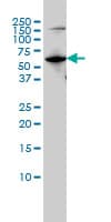 MUTYH / MYH Antibody (clone 4D10)