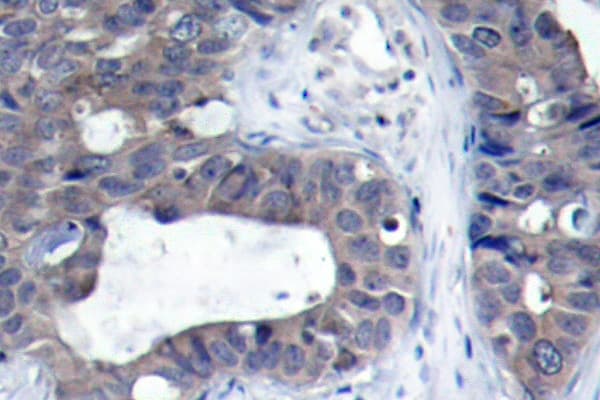 IRS1 Antibody (Arg301)