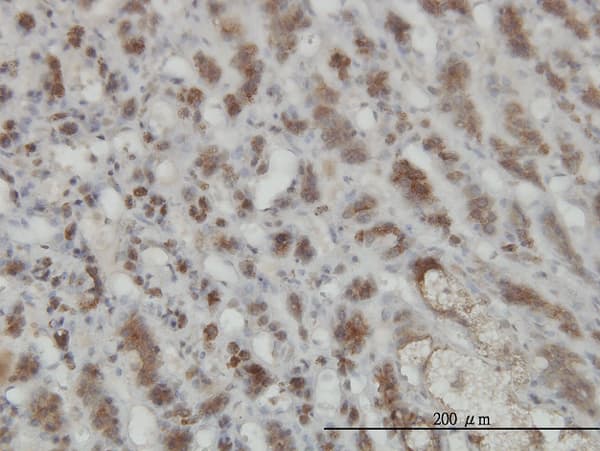 GMPPB Antibody (clone 2B5)