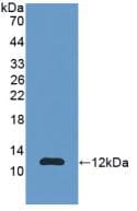 Calgizzarin / S100A11 Antibody (aa1-105, FITC)