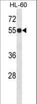 IHC-plus™ Polyclonal Rabbit anti-Human IMPDH1 Antibody (aa84-113, IHC, WB)