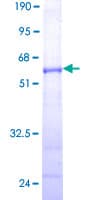 Human CELA3A / ELA3 Protein (Recombinant GST)