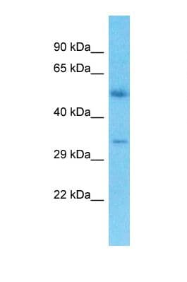 CRD / CRX Antibody (aa23-72)
