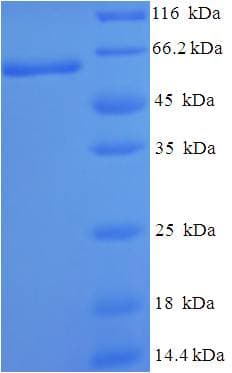 Human GRB4 / NCK2 Protein (Recombinant His-SUMO)