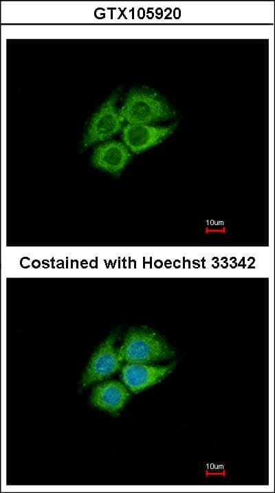 Polyclonal Rabbit anti-Human PANK1 / PANK Antibody (aa207-513, IHC, WB)