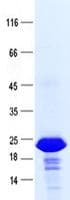 Human SOD1 / Cu-Zn SOD Protein (Recombinant His, N-Terminal)