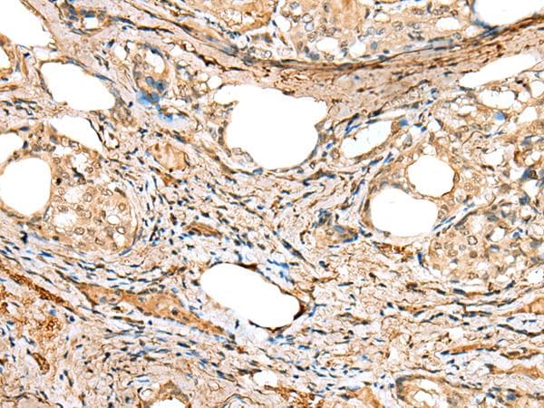 Polyclonal Rabbit anti-Human ATXN7L3 Antibody (IHC)