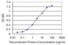 IHC-plus™ CTHRC1 Antibody (clone 1G12)