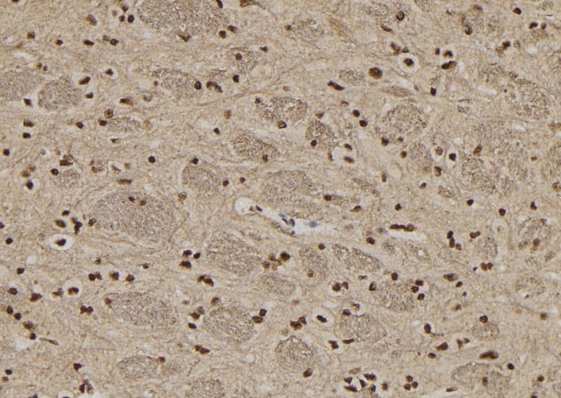 COIL / Coilin Antibody