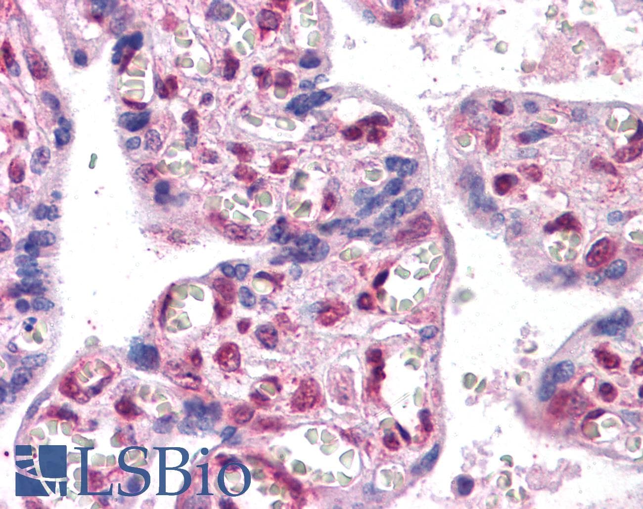 IHC-plus™ Polyclonal Goat anti-Human FOXP2 Antibody (aa484-497, IHC, WB)