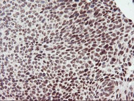 RNF113B Antibody (clone OTI2C10, Carrier-free)