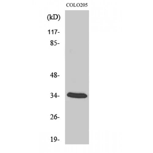 Polyclonal Rabbit anti-Human GAX / MEOX2 Antibody (120-200 aa, Internal, IHC, WB)
