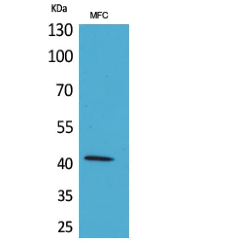 ACTA1 / Skeletal Muscle Actin Antibody (C-terminal)
