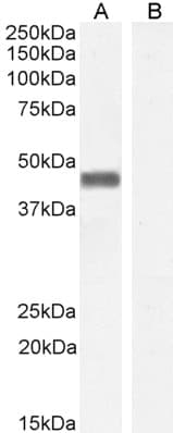 IHC-plus™ PLEK / Pleckstrin Antibody (aa337-350)
