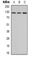 TERT / Telomerase Antibody (Internal)