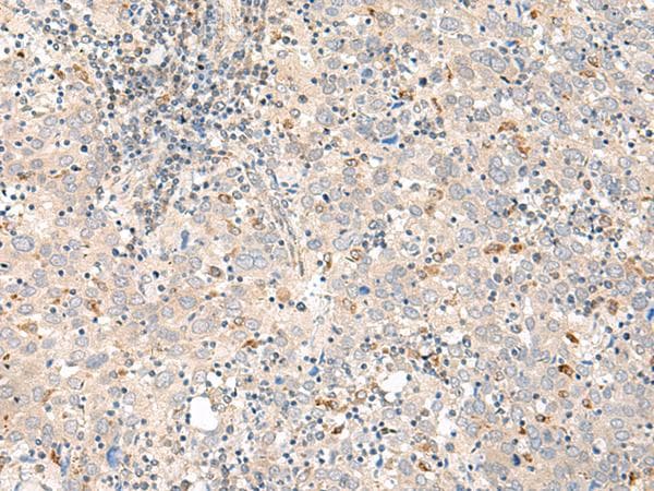 GALR1 / Galanin Receptor 1 Antibody