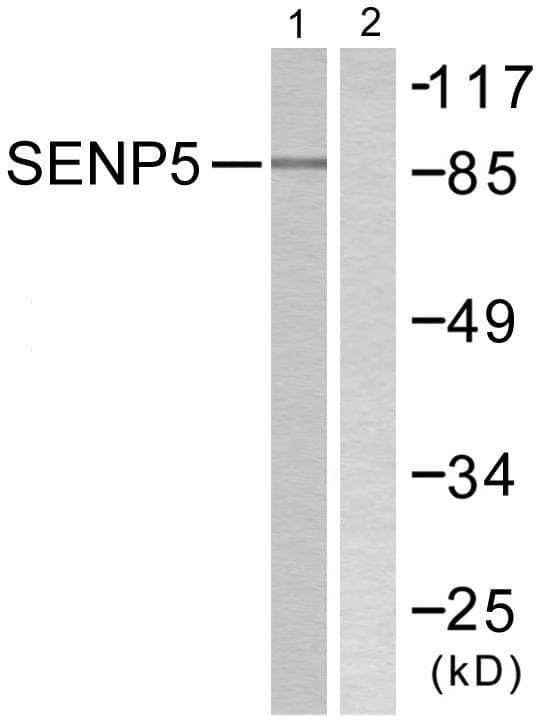Polyclonal Rabbit anti-Human SENP5 Antibody (IHC, WB)