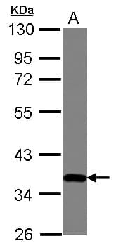 ZNF177 / PIGX Antibody