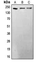 Polyclonal Rabbit anti-Human BRCA1 Antibody (C-Terminus, IHC, WB)