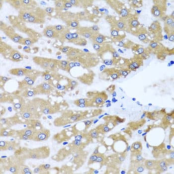 NDUFS3 Antibody
