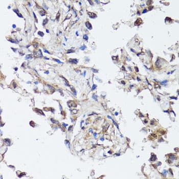 SIRT1 / Sirtuin 1 Antibody