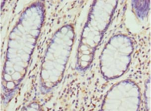 Polyclonal Rabbit anti-Human CCT5 / TCP1 Epsilon Antibody (IHC, WB)