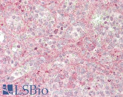 JAG1 / Jagged 1 Antibody (aa33-250)