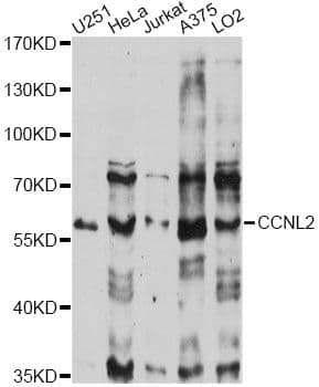 Polyclonal Rabbit anti-Human CCNL2 / Cyclin L2 Antibody (WB)