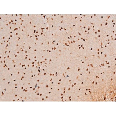 Polyclonal Rabbit anti-Human SYK Antibody (phospho-Tyr348, IHC, IF, WB)